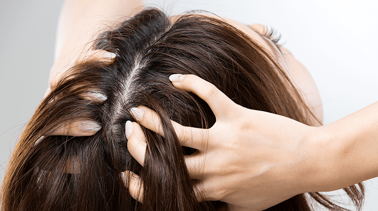 頭皮トラブルの原因は洗いすぎ スカルプケアシャンプーで艶やかな髪へ アビスタオンラインショップ