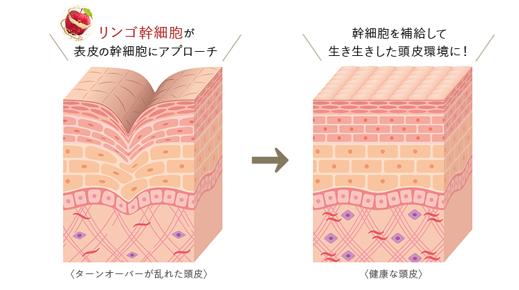 頭皮トラブルの原因は洗いすぎ スカルプケアシャンプーで艶やかな髪へ アビスタオンラインショップ